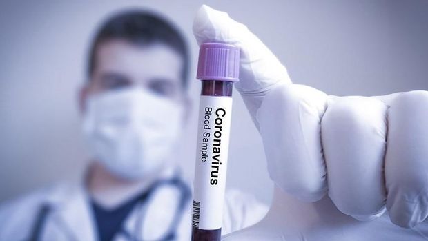 Türkiyədə koronavirusla bağlı son statistika