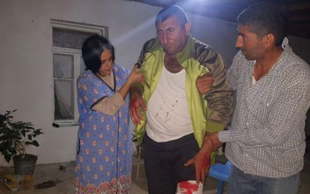 Ermənilərin yaraladığı mülki vətəndaşımızın - Fotosu