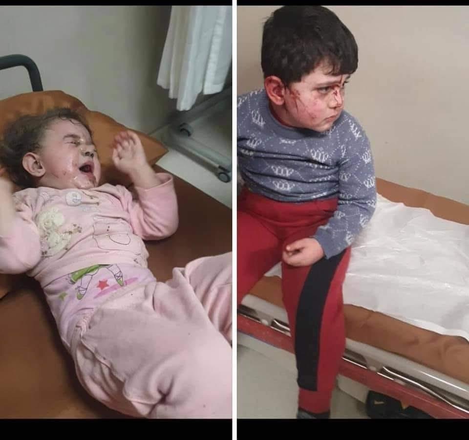 Gəncənin atəşə tutulması nəticəsində xəsarət alanlar arasında uşaqlar da var