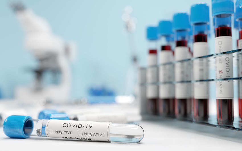 Daha 34 şagird və 21 işçidə koronavirus aşkarlandı