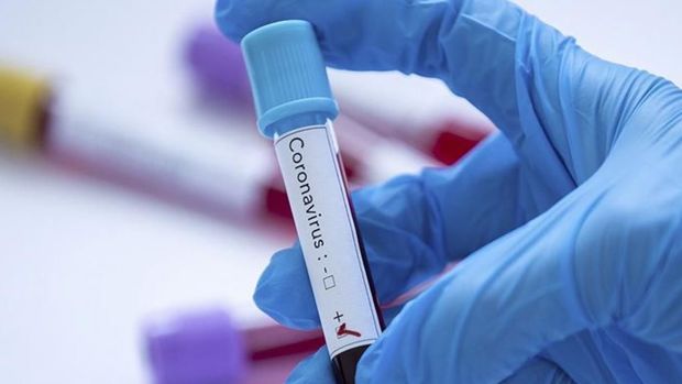 Koronavirus mutasiyaya uğrayıb: 260 dəfə daha təhlükəli hal alıb - VİDEO