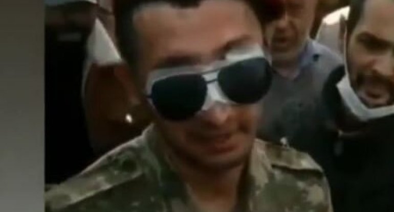 Atanın hər iki gözünü itirmiş oğluna dediyi sözlər hər kəsi kövrəltdi - VİDEO