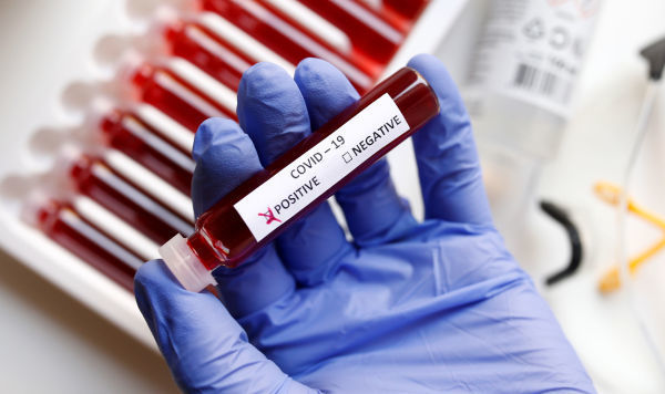 Evi tərk edən 29 aktiv koronavirus xəstəsi müəyyən edilərək saxlanıldı