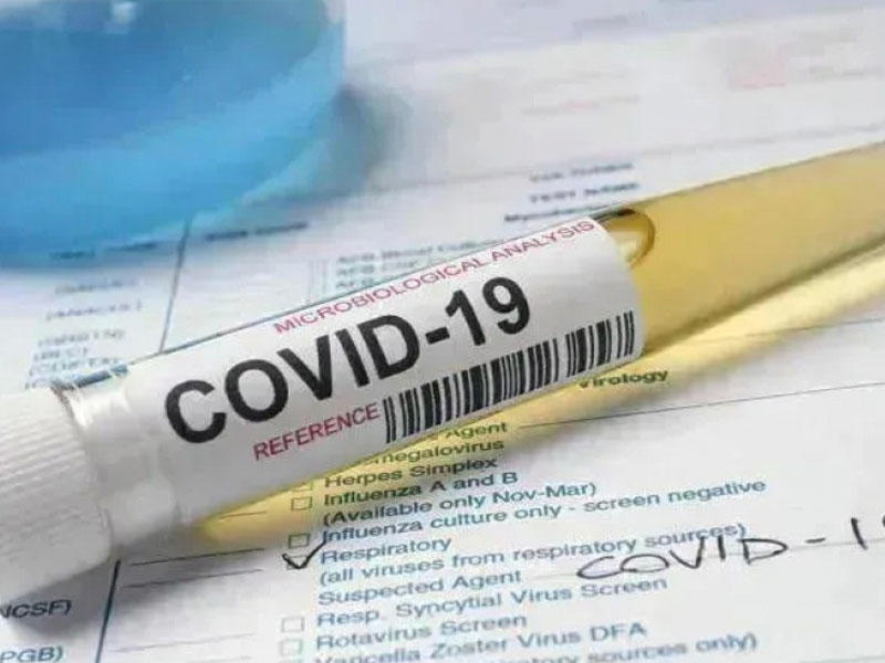 Azərbaycanda son sutkada COVID-19-a yoluxanların sayı açıqlandı