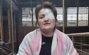 Gəncə vurulanda sol gözünü itirən qadın: “Evim dağılıb, icra başçısı məni qəbul etmir”