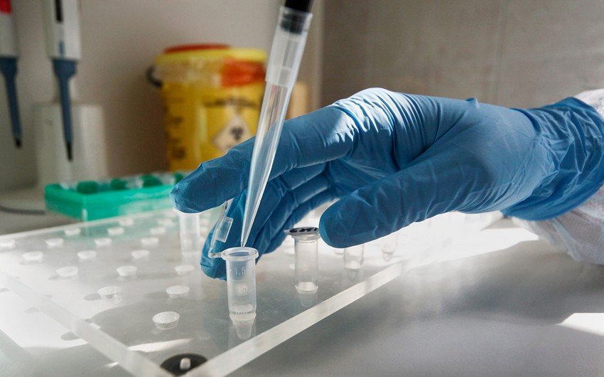 Gürcüstanda daha 780 nəfərdə koronavirus aşkarlanıb, 17 pasiyent ölüb