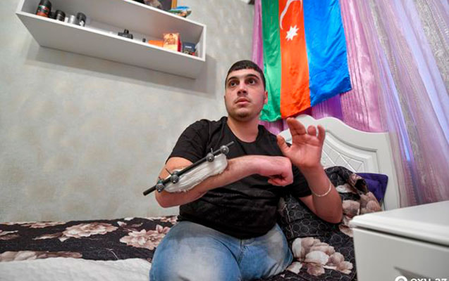Ayaqlarını itirən 20 yaşlı Qarabağ qazisi üçün protez hazırlıqlarına başlanıldı - RƏSMİ