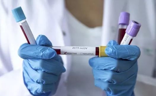 Türkiyədə son koronavirus statistikası açıqlandı