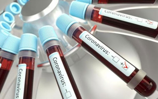 Azərbaycanda koronavirusa yoluxanların bu günə olan statistikası