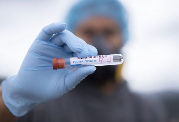 Son günlər Azərbaycanda koronavirus niyə artır? - AÇIQLAMA