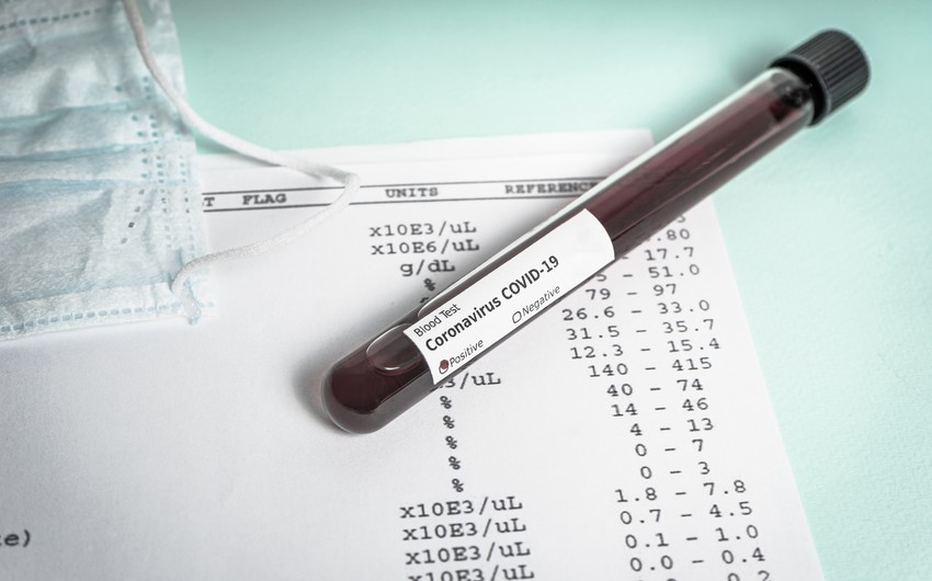 İndoneziyada koronavirus testinin cavabı 3 dəqiqəyə hazır olacaq