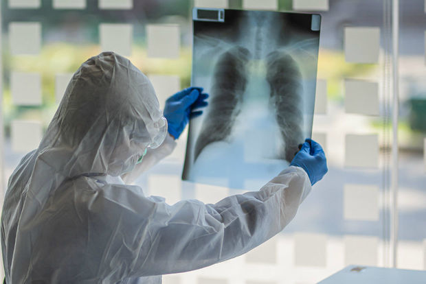 İctimai yerlərdə aşkarlanan koronavirus xəstələri barəsində cinayət işi başlandı