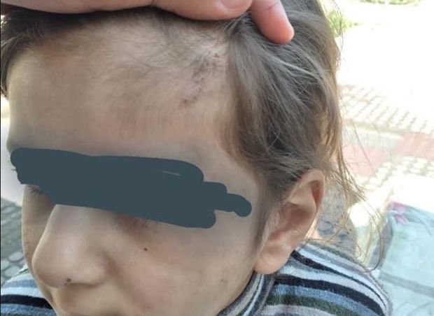 Atası tərəfindən şiddətə məruz qalan uşaqla bağlı məsələ DİN-in nəzarətindədir - FOTO