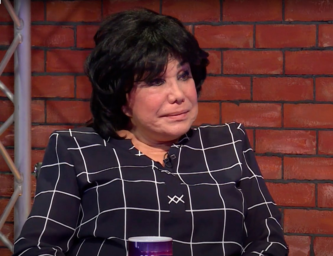 Flora Kərimova: “Biri 5 yaşlı uşağın dilini, digəri pişiyin ayağını kəsir”