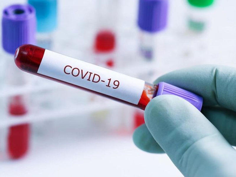 Rusiyada COVID-19-dan ölənlərin sayı 166 mini ötüb