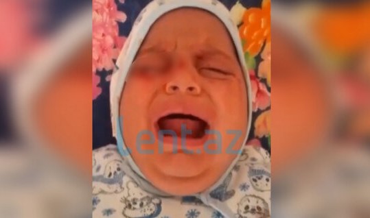 Azərbaycanda ŞOK: Körpənin gözlərinə COVID diaqnozu qoyuldu, 2 aydır qan gəlir - VİDEO