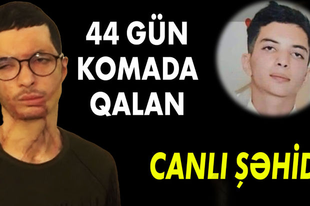 Müharibədə yanında minamyot mərmisi partladı, tanınmaz hala düşdü - VİDEO