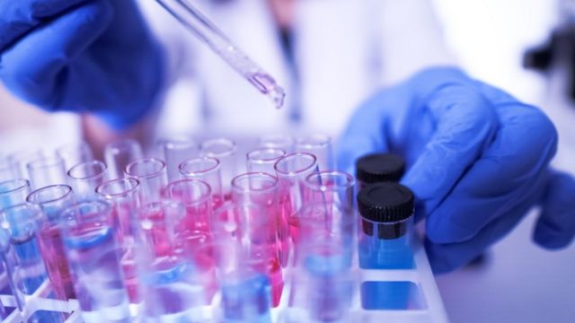 Azərbaycanda koronavirusdan ölənlərin sayı artdı