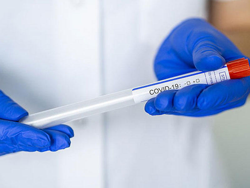 Gürcüstanda COVID-19-a yoluxanların sayı 700 mini ötüb
