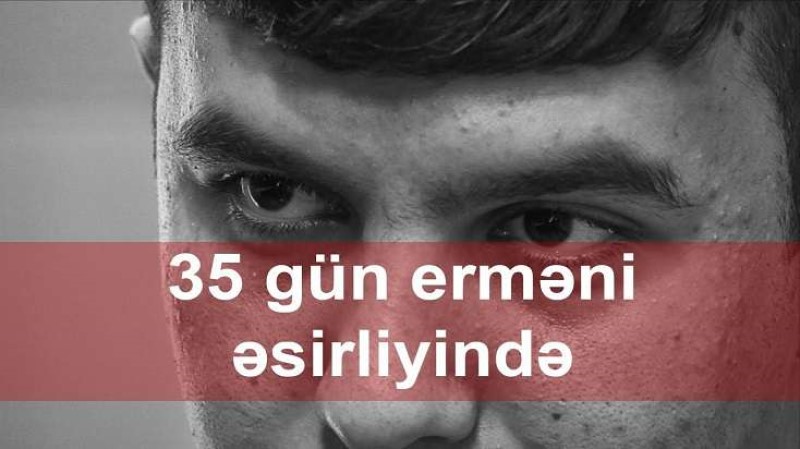 "Ayıldım ki, İrəvandayam, ayağımı kəsiblər" - 35 gün erməni əsirliyində - VİDEO