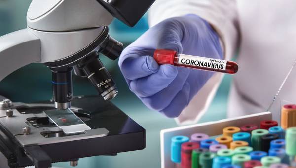 Azərbaycanda koronavirusa yoluxanların bu günə olan statistikası