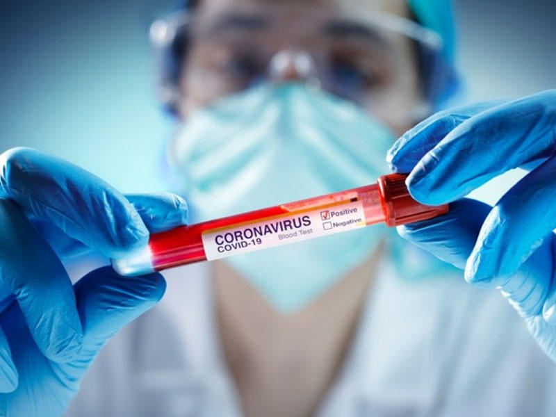 Gürcüstanda daha 4 331 nəfər koronavirusa yoluxdu