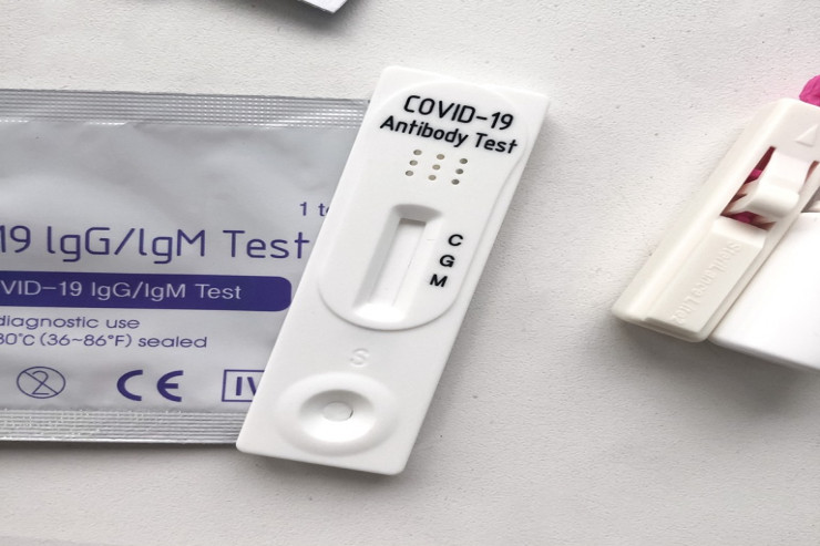 Bu ölkədə COVID testi müsbət çıxanlara pul veriləcək