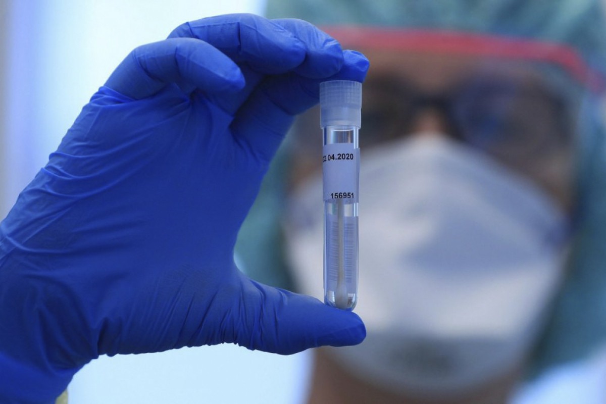 “Omicron”un iki yeni simptomu aşkarlandı