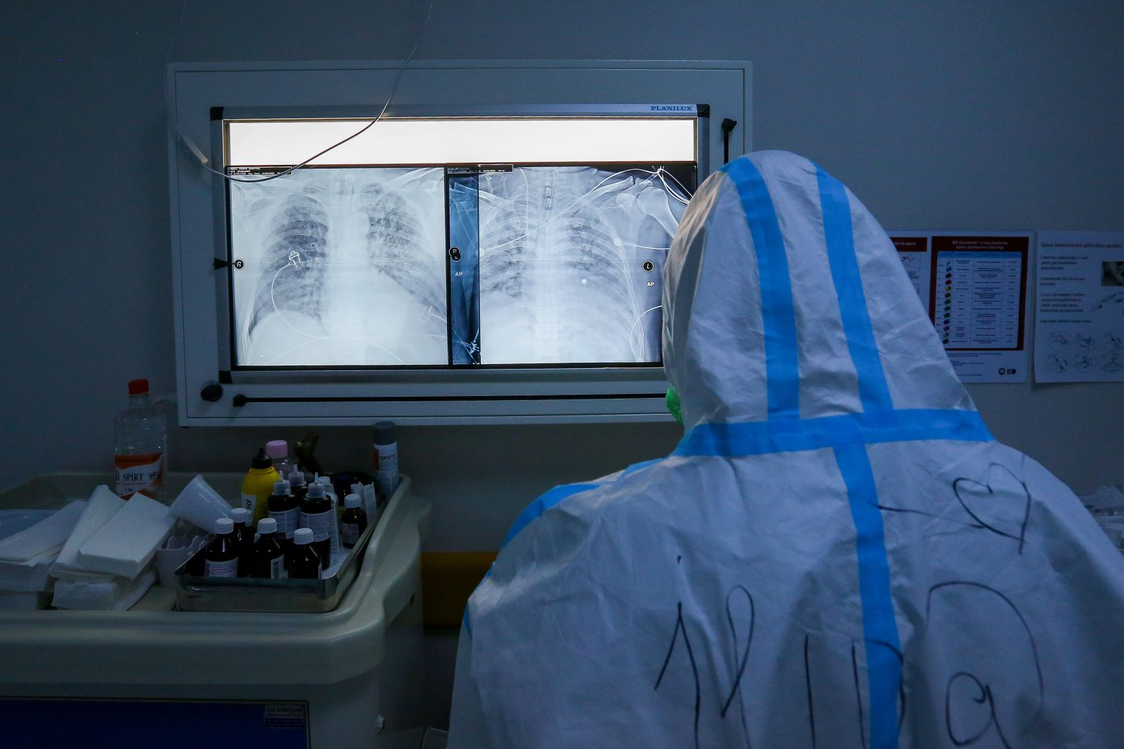 Qaydaları heçə sayan 14 koronavirus xəstəsi aşkarlandı