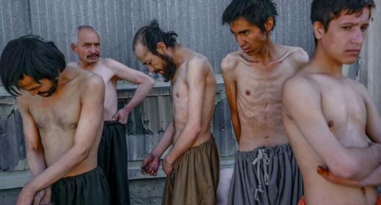 Xəstəxanada DƏHŞƏT: Narkomanlar bir-birini öldürüb yeyirlər