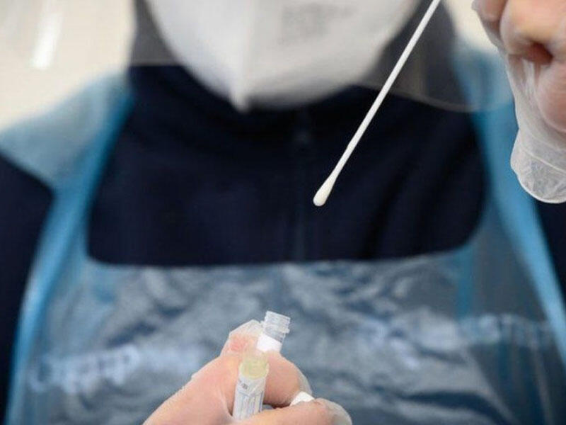 Niyə COVID-19 testinin cavabları gec çıxır? - AÇIQLAMA 