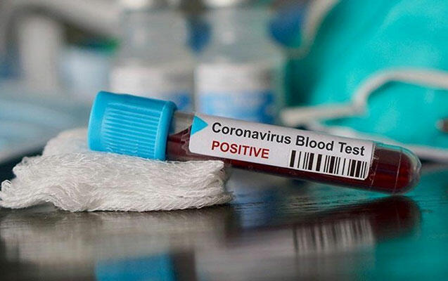Türkiyədə koronavirusla bağlı son statistika