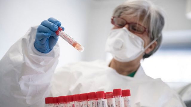 Azərbaycanda koronavirusa yoluxanların sayı azaldı