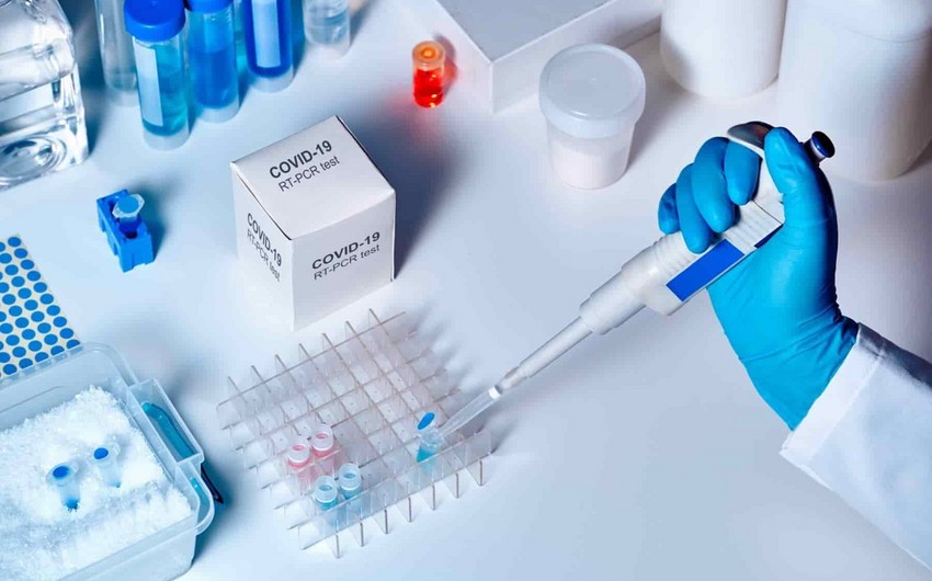 Azərbaycanda koronavirusa yoluxanların bu günə olan statistikası