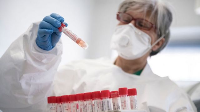 Azərbaycanda günlük koronavirusa yoxulanların sayı 40-a endi