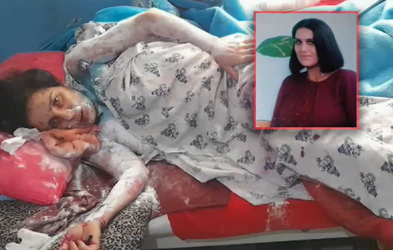 Azərbaycanda gəlinini kimyəvi maddə ilə yandıran qayınata: "Yaxşı eləmişəm" - VİDEO