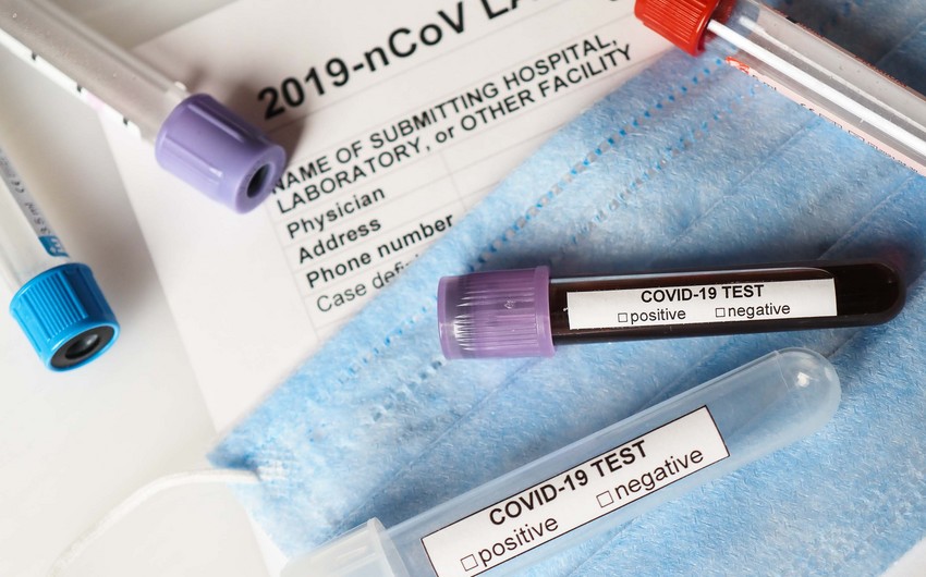 Azərbaycanda aktiv koronavirus xəstələrinin sayı 100-dən aşağı düşdü
