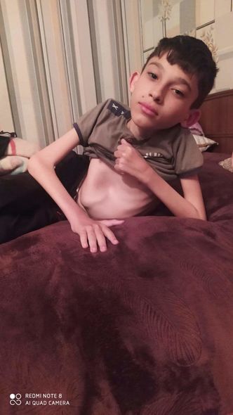 SMA xəstəsi olan bacı-qardaşın köməyinizə ehtiyacı var - FOTO