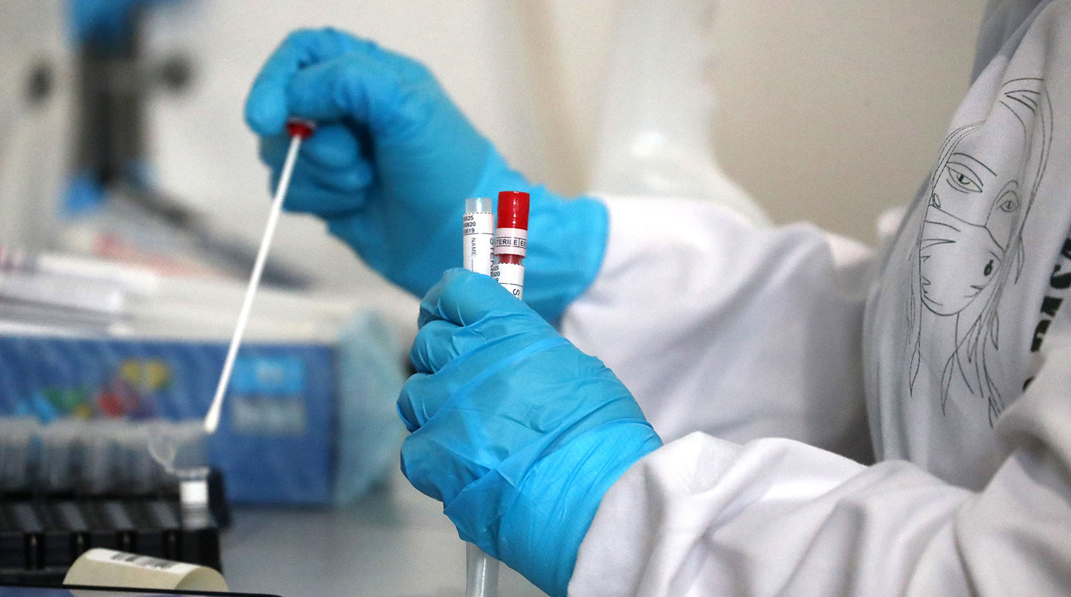 Azərbaycanda son sutkada koronavirusa yoluxanların statistikası