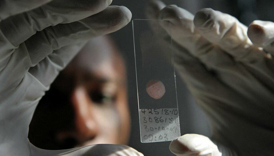 ÜST bu xəstəliyi də epidemiya adlandırdı