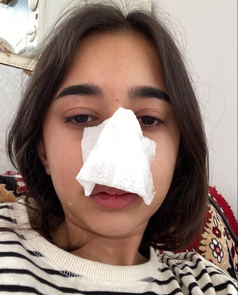 Bakıda gənc qız sevgilisi tərəfindən döyüldü - FOTO