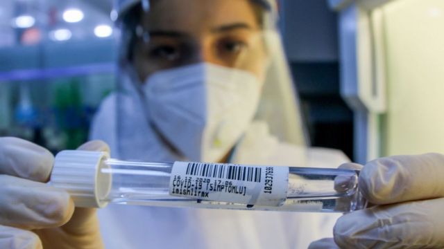 Son sutkada koronavirusa yoluxanların statistikası