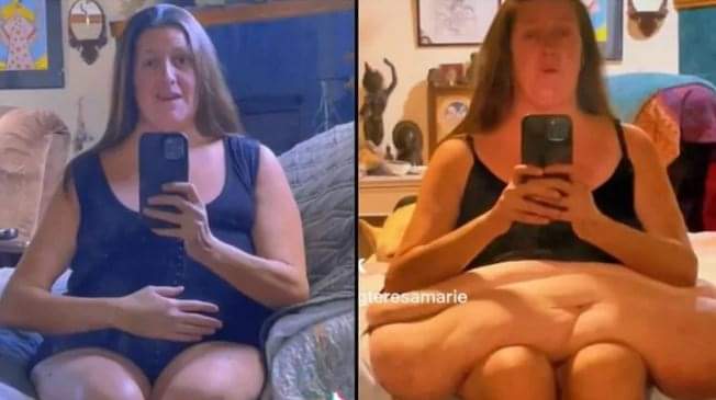 44 yaşlı qadın 5 ildə 190 kilo arıqladı: Hər kəs bu ondan danışır - FOTO