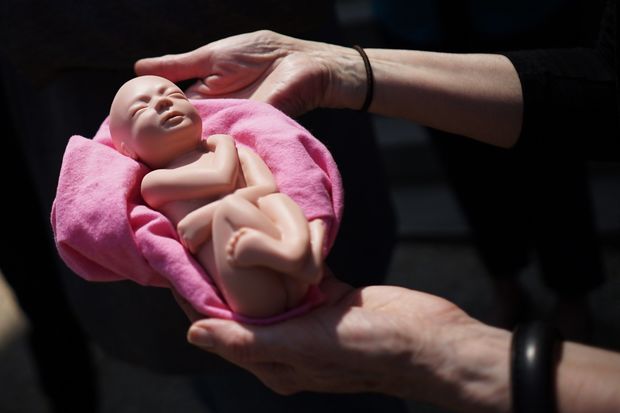 Azərbaycanda 15-19 yaşlı qızlar arasında qeydə alınan abortların sayı AÇIQLANDI