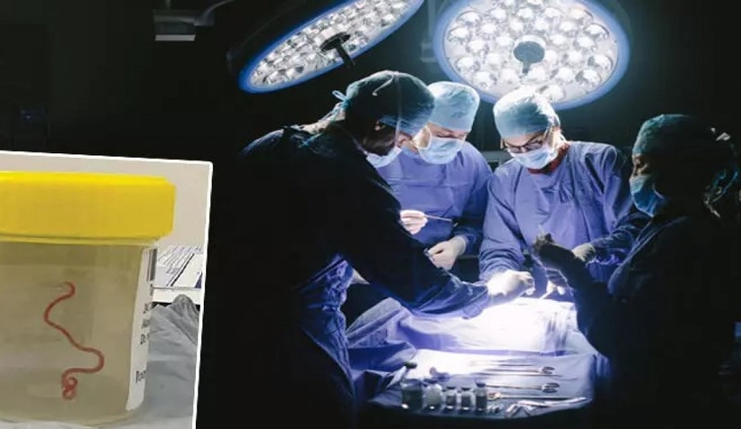 Tibb dünyasını şoka salan hadisə: Qadının beynindən canlı qurd çıxarıldı