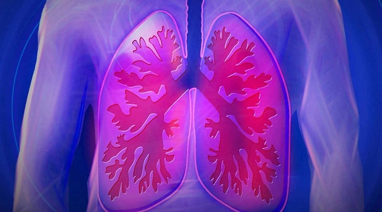 “Legionella bakteriyası” can almaqda davam edir: Ölənlərin sayı 16-ya yüksəldi