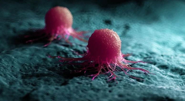 Yeni xərçəng araşdırması qorxuya səbəb oldu: virus kimi yayılır