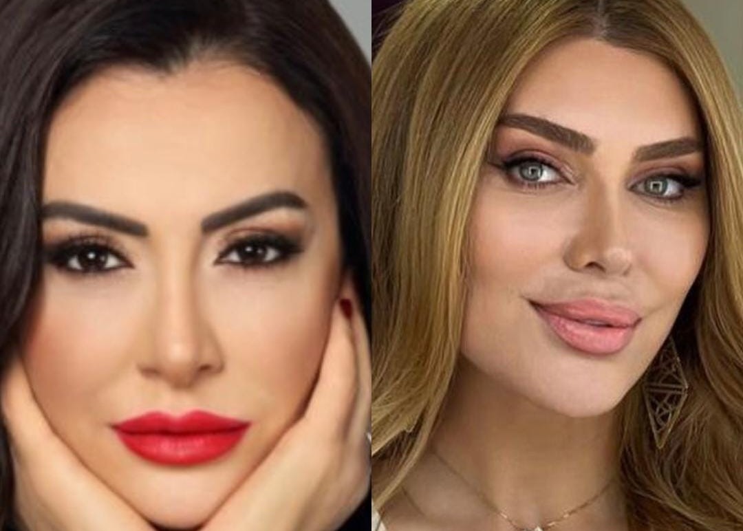 Xoşqədəm Hidayətqızı türk aparıcını bağışlamadı