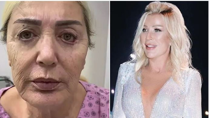 Seda Sayanın bacısı estetik əməliyyatdan sonra - FOTO