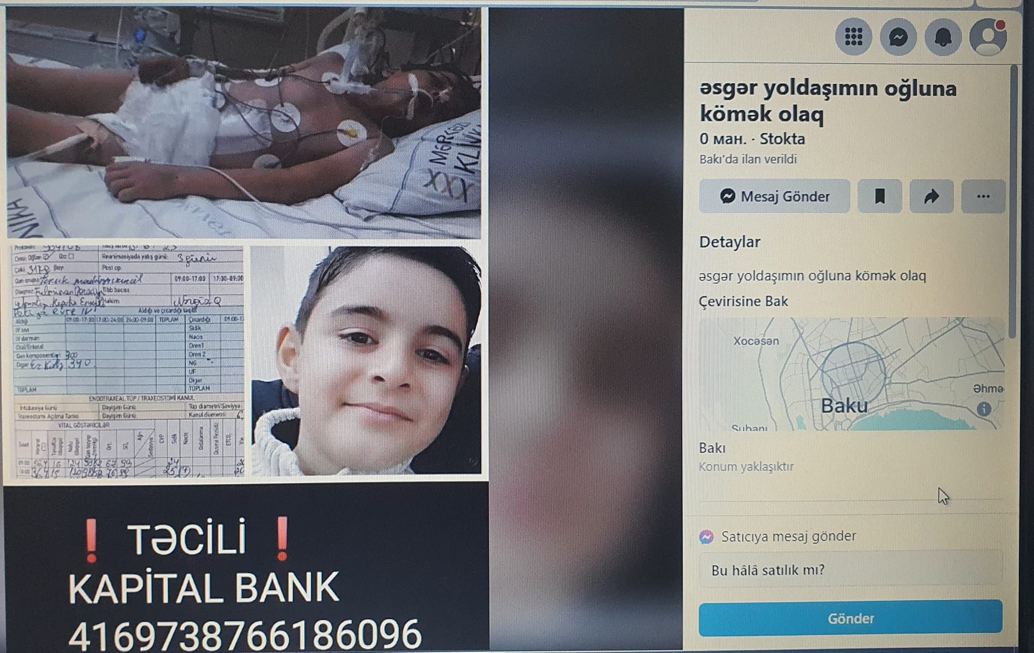 Azərbaycanda ağlasığmaz hadisə - Sosial şəbəkələrdə ölən uşağın fotosu ilə pul yığırlar - FOTO